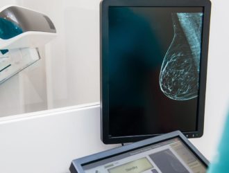 breast cancer risk factors