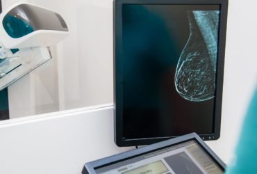 breast cancer risk factors